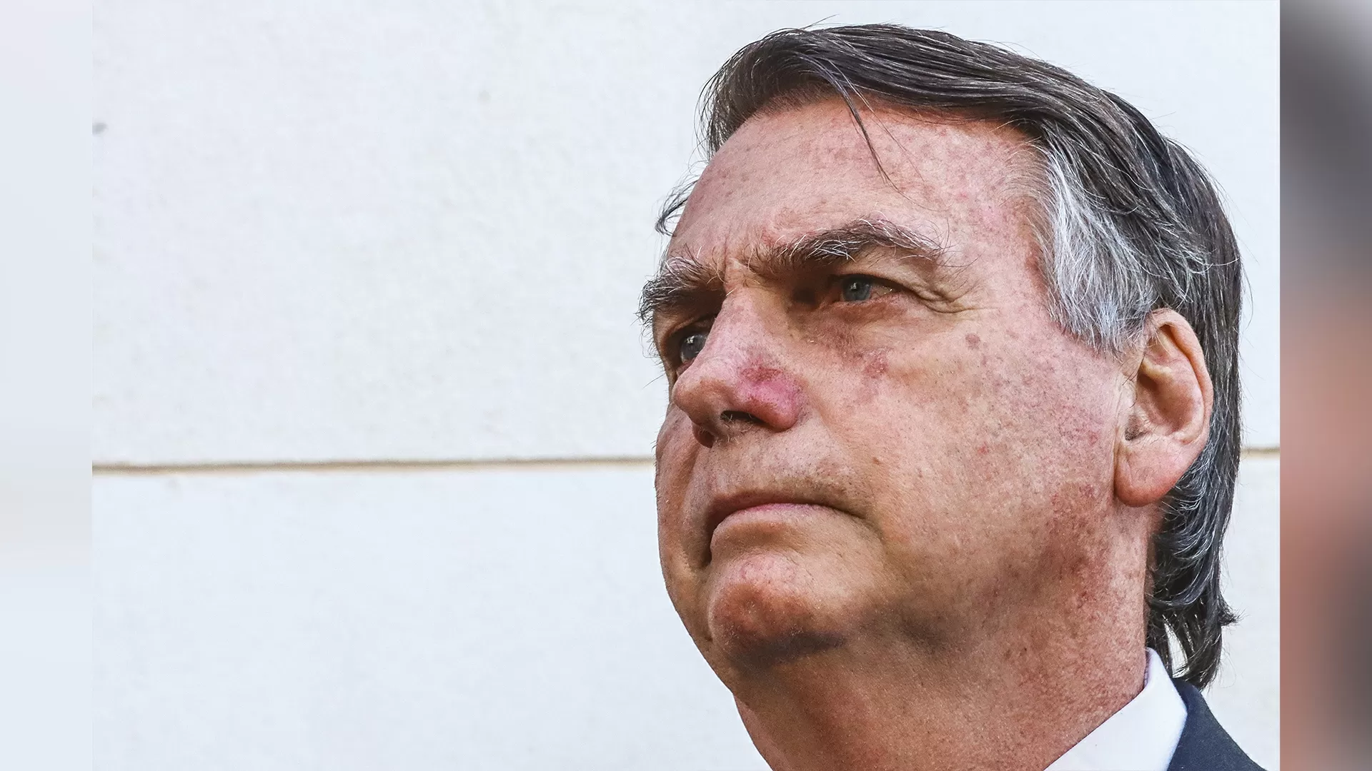 Apneia do sono e CPAP: entenda distúrbio que afeta Bolsonaro e o tratamento