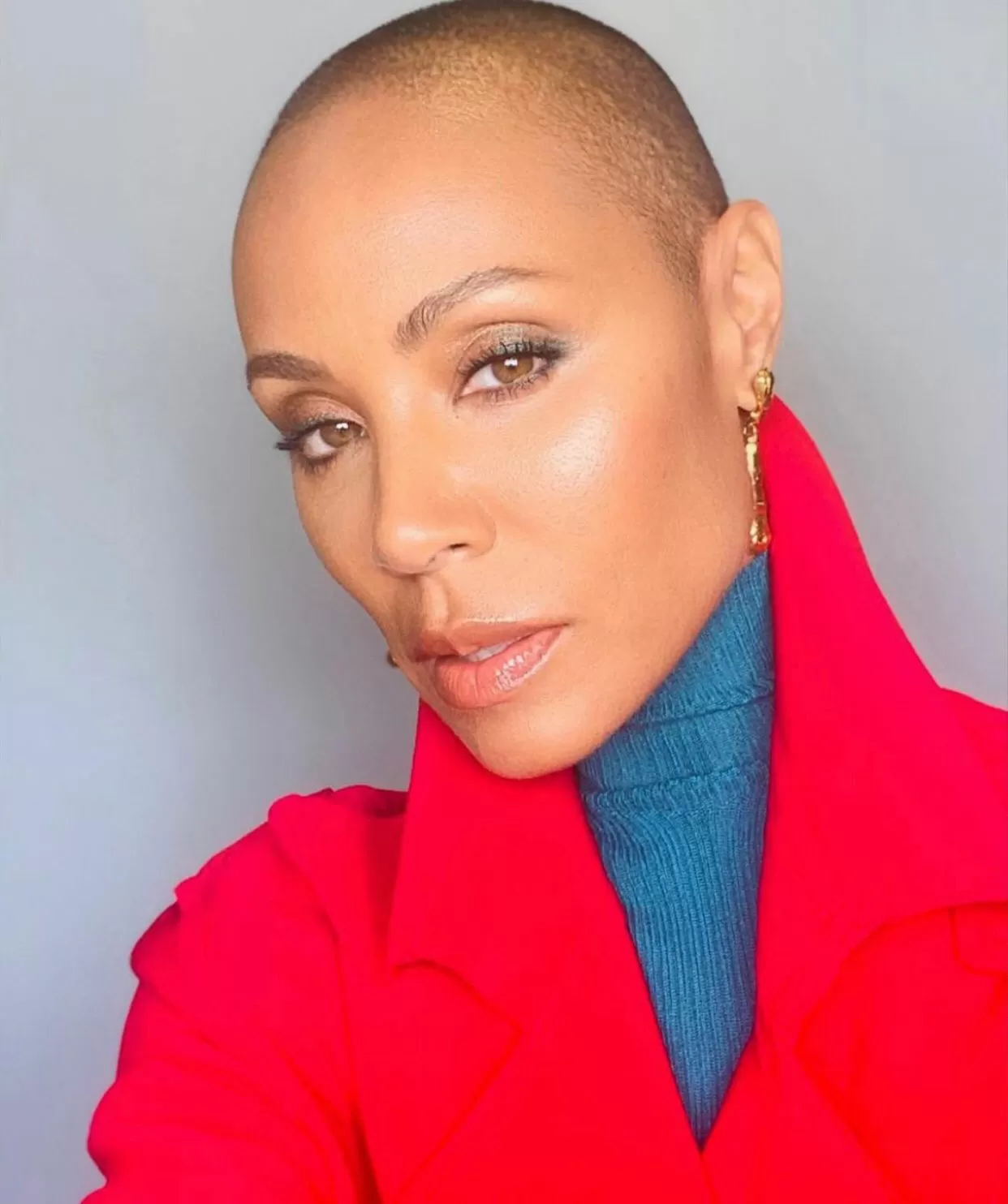 Medicamento para alopecia, que faz perder o cabelo, é aprovado no Brasil