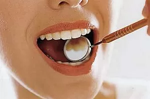 O benefício do canabidiol para os dentes, segundo estudo