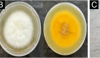 Primeiro caso e surto: os superfungos que preocupam hospitais brasileiros