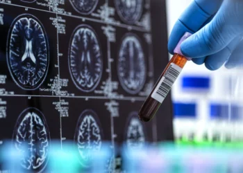 Exame brasileiro tem precisão de até 94% no diagnóstico do Alzheimer