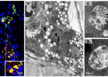 Covid: vírus usa células dos testículos para se multiplicar; entenda