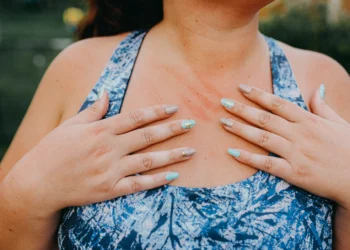 Remédio que reduz em 63% coceira por doença crônica é nova opção de tratamento no Brasil