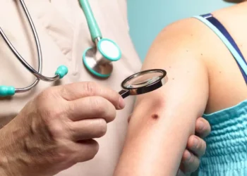 A faixa etária em que o câncer de pele disparou no Brasil