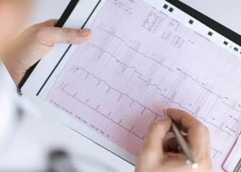 Tabagismo e colesterol são fatores-chave para enfartes precoces