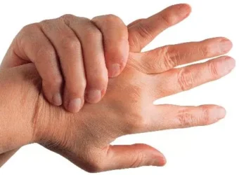 Implante cerebral promete mudar tratamento da artrite reumatoide