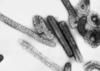 Etiópia registra primeiro surto de doença ‘prima’ do Ebola